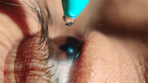 steroid eye drops drug test|can steroid eye drops cause vision.